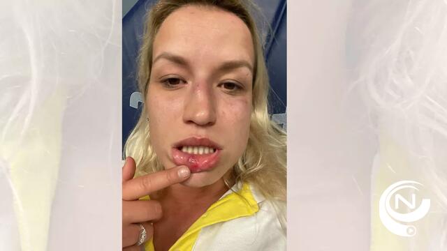 Minderjarige (17) slaat buschauffeur Jilke werkonbekwaam aan station Herentals :  'Dit moet direct stoppen voor altijd!'